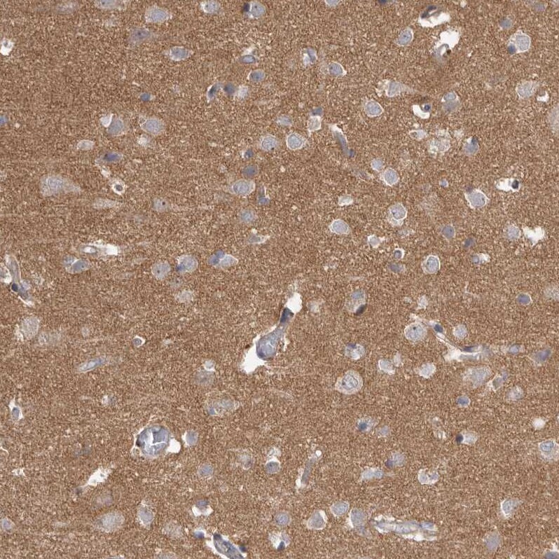 HINT3 Antibody - BSA Free Immunohistochemistry-Paraffin: HINT3 Antibody [NBP1-81981]