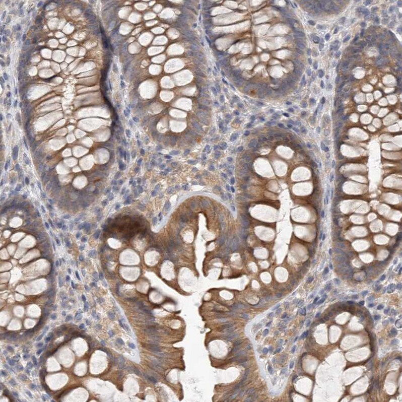 HINT3 Antibody - BSA Free Immunohistochemistry-Paraffin: HINT3 Antibody [NBP1-81981]