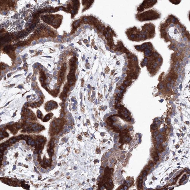 VPS8 Antibody - BSA Free Immunohistochemistry: VPS8 Antibody - BSA Free [NBP1-82007]