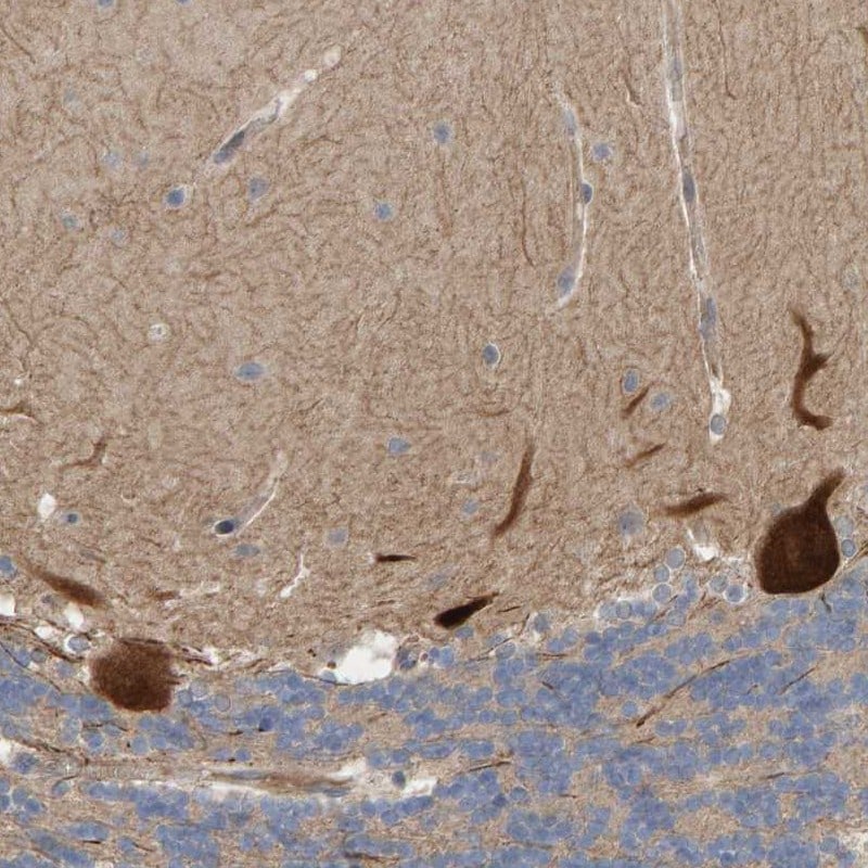 LRSAM1 Antibody - BSA Free Immunohistochemistry-Paraffin: LRSAM1 Antibody [NBP1-82017]