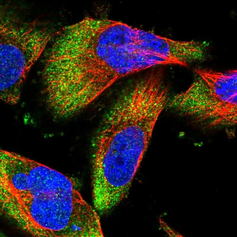 DCP1B Antibody - BSA Free Immunocytochemistry/ Immunofluorescence: DCP1B Antibody [NBP1-82018]