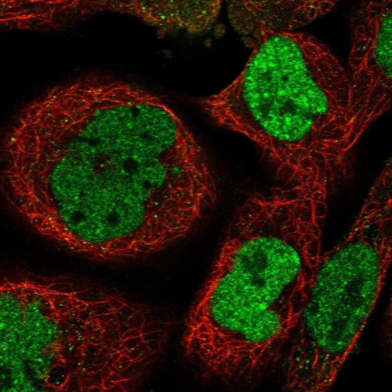 ZNF570 Antibody - BSA Free Immunocytochemistry/ Immunofluorescence: ZNF570 Antibody [NBP1-82035]