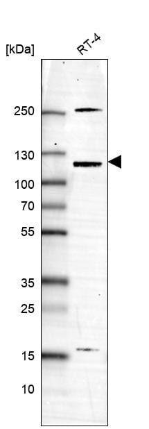 USP43 Antibody Western Blot: USP43 Antibody [USP43 Antibody]