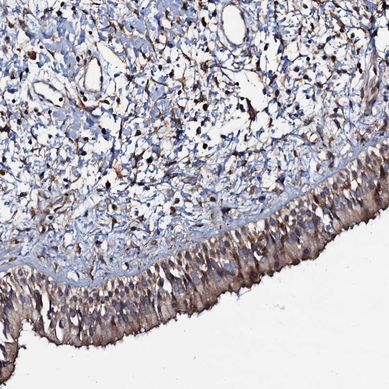 KxDL motif containing 1 Antibody - BSA Free Immunohistochemistry-Paraffin: KxDL motif containing 1 Antibody [NBP1-82055]