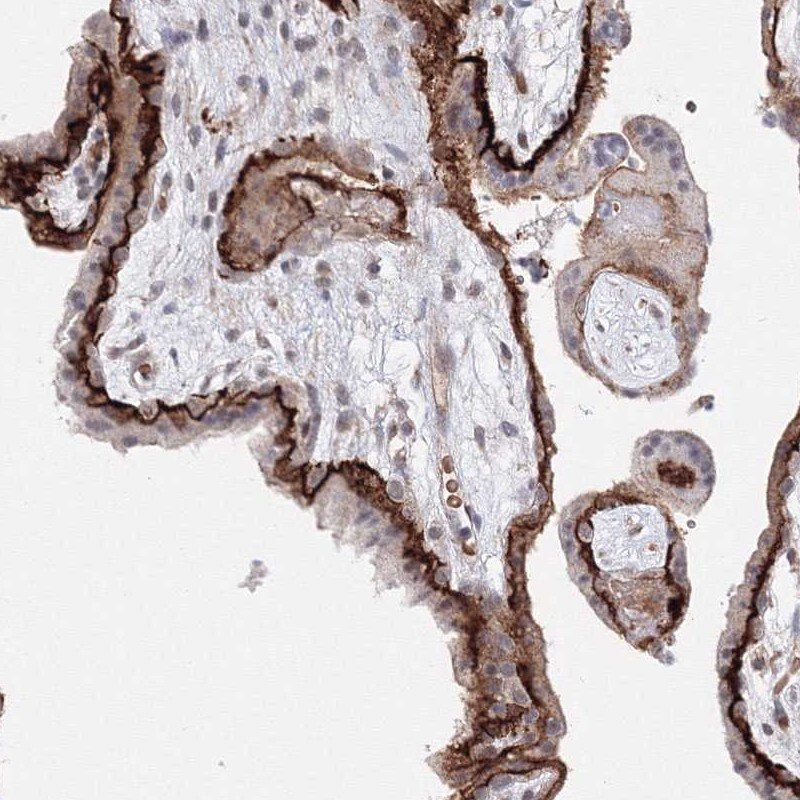 C11orf52 Antibody - BSA Free Immunohistochemistry-Paraffin: C11orf52 Antibody [NBP1-82060]