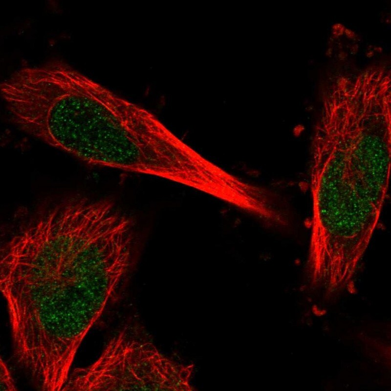 C11orf1 Antibody - BSA Free Immunocytochemistry/ Immunofluorescence: C11orf1 Antibody [NBP1-82071]