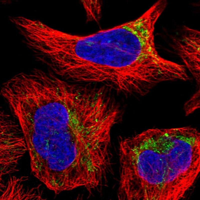 YRDC Antibody - BSA Free Immunocytochemistry/ Immunofluorescence: YRDC Antibody [NBP1-82072]