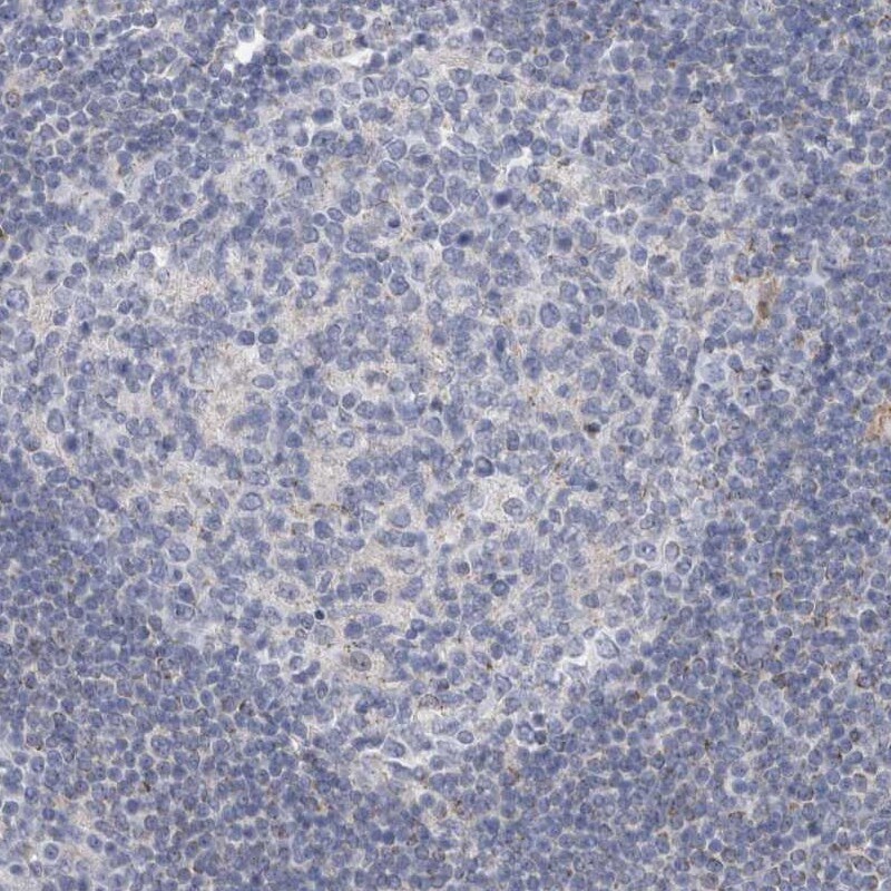 AGMAT Antibody - BSA Free Immunohistochemistry-Paraffin: AGMAT Antibody [NBP1-82080]