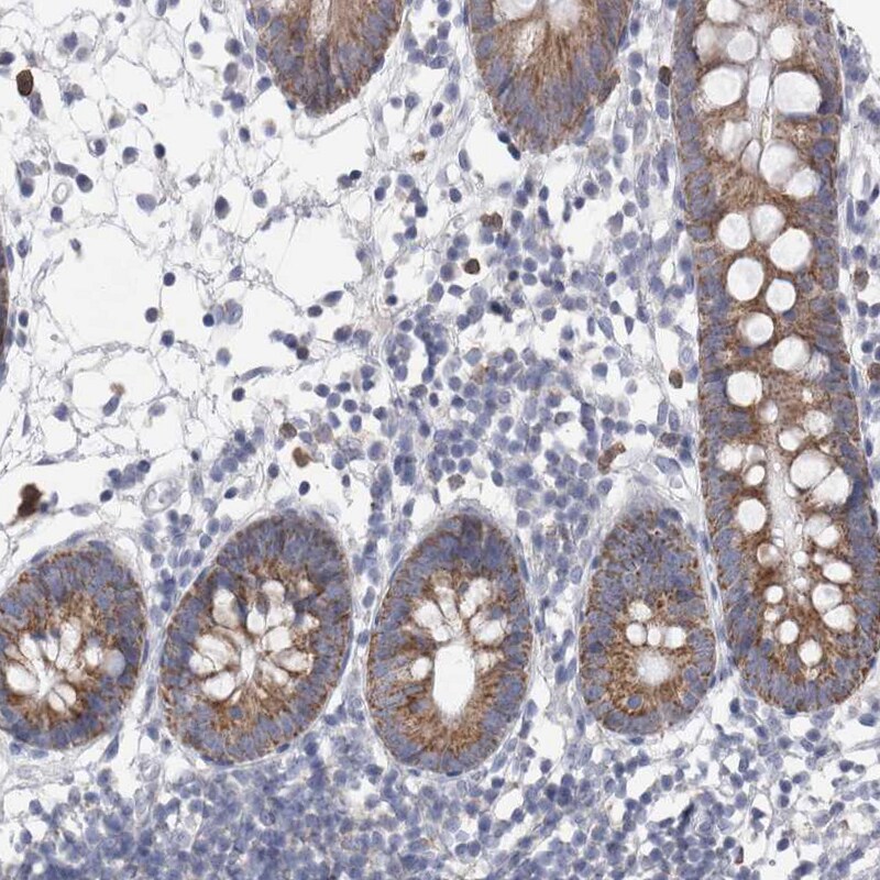 AGMAT Antibody - BSA Free Immunohistochemistry-Paraffin: AGMAT Antibody [NBP1-82080]
