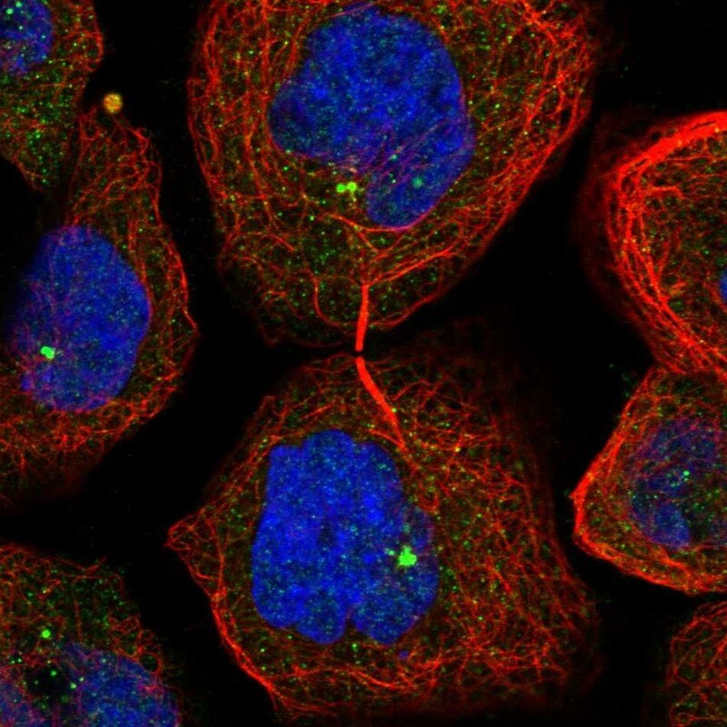 TTI2 Antibody - BSA Free Immunocytochemistry/ Immunofluorescence: TTI2 Antibody [NBP1-82085]