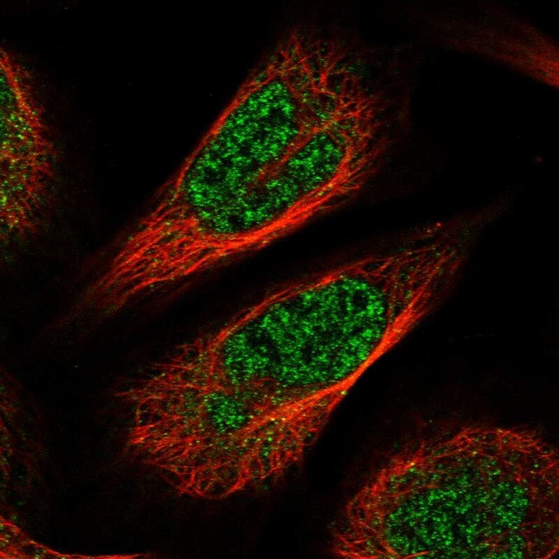 CCDC126 Antibody - BSA Free Immunocytochemistry/ Immunofluorescence: CCDC126 Antibody [NBP1-82093]