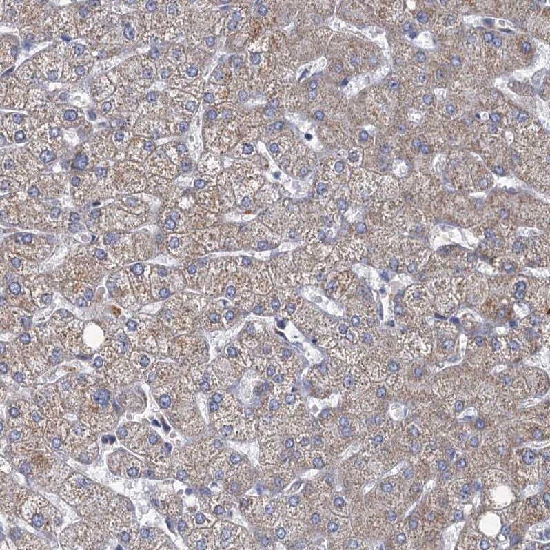 METTL4 Antibody - BSA Free Immunohistochemistry: METTL4 Antibody - BSA Free [NBP1-82095]