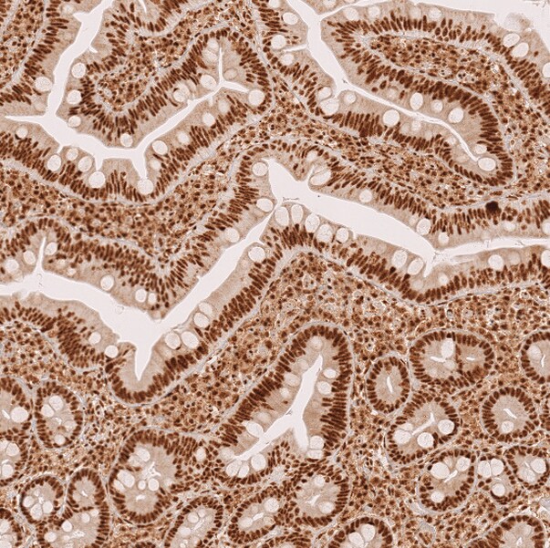 METTL4 Antibody - BSA Free Immunohistochemistry: METTL4 Antibody - BSA Free [NBP1-82095]