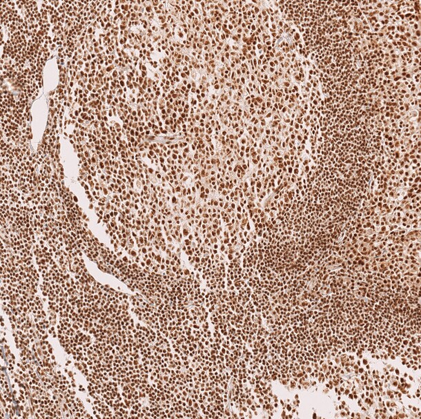 METTL4 Antibody - BSA Free Immunohistochemistry: METTL4 Antibody - BSA Free [NBP1-82095]