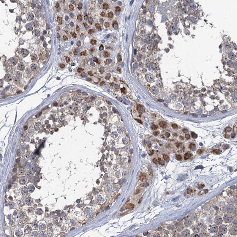 METTL4 Antibody - BSA Free Immunohistochemistry: METTL4 Antibody - BSA Free [NBP1-82095]