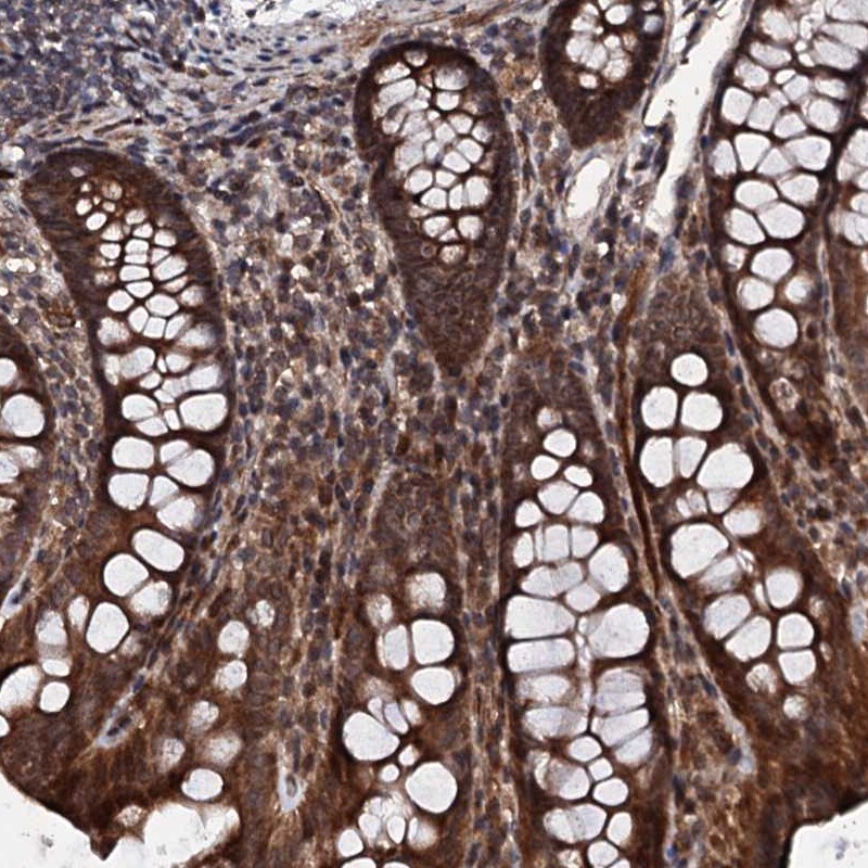 FAM111A Antibody - BSA Free Immunohistochemistry: FAM111A Antibody - BSA Free [NBP1-82104]