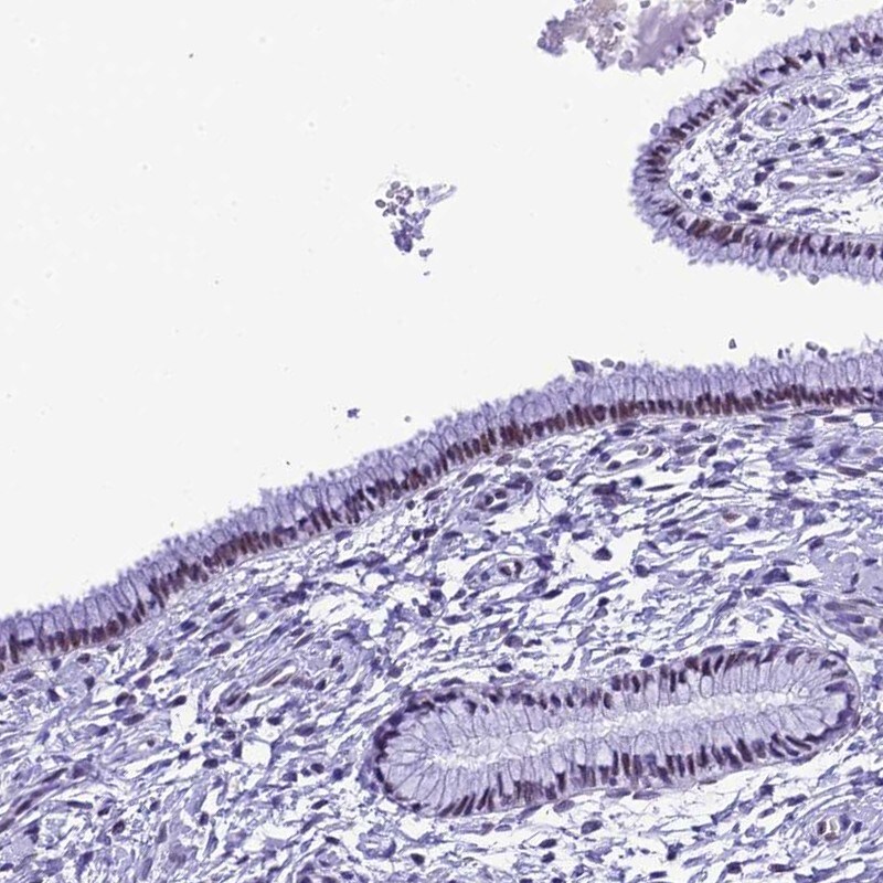 METTL25 Antibody - BSA Free Immunohistochemistry: METTL25 Antibody - BSA Free [NBP1-82106]