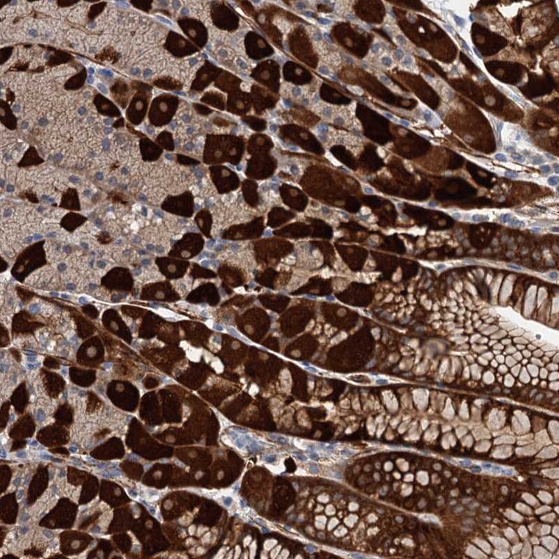 C11orf49 Antibody - BSA Free Immunohistochemistry-Paraffin: C11orf49 Antibody [NBP1-82128]