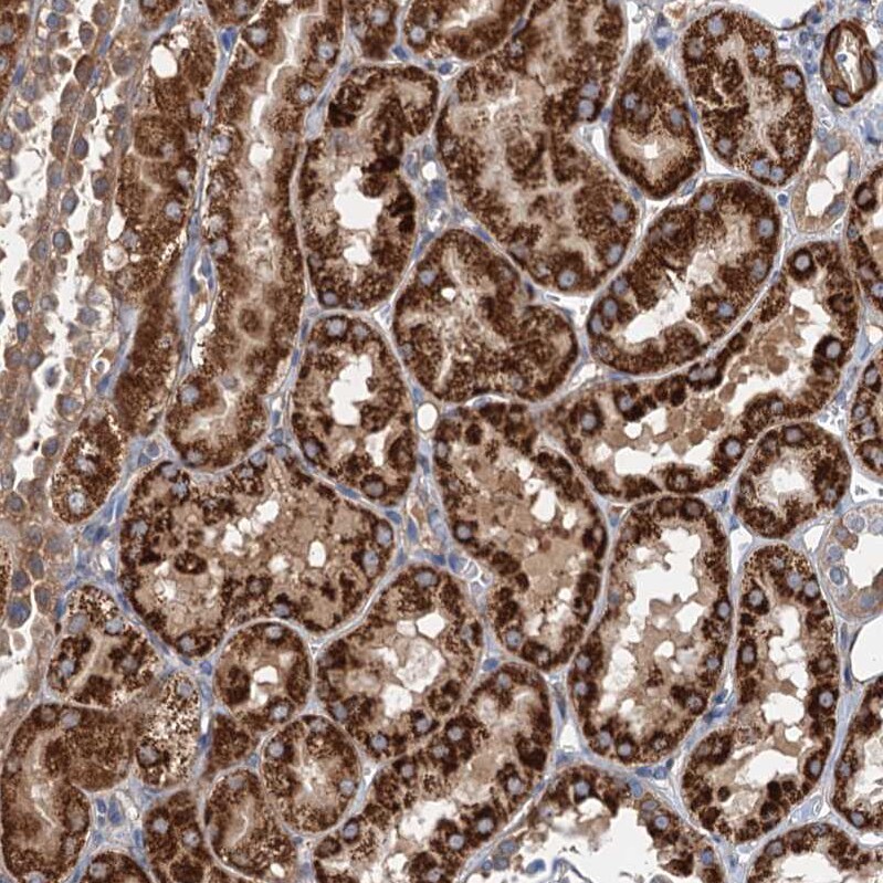 C11orf49 Antibody - BSA Free Immunohistochemistry-Paraffin: C11orf49 Antibody [NBP1-82128]