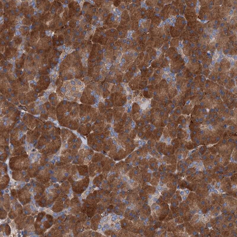 C11orf49 Antibody - BSA Free Immunohistochemistry-Paraffin: C11orf49 Antibody [NBP1-82128]