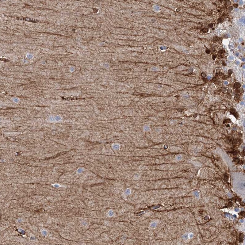 C11orf49 Antibody - BSA Free Immunohistochemistry-Paraffin: C11orf49 Antibody [NBP1-82128]