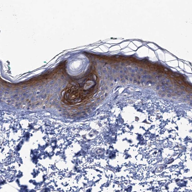 SCEL Antibody - BSA Free Immunohistochemistry-Paraffin: SCEL Antibody [NBP1-82138]