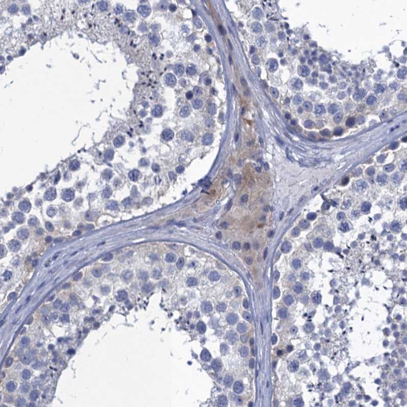 SCEL Antibody - BSA Free Immunohistochemistry-Paraffin: SCEL Antibody [NBP1-82138]