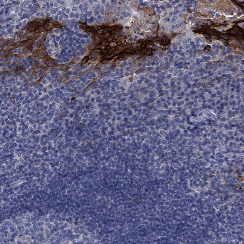 SCEL Antibody - BSA Free Immunohistochemistry-Paraffin: SCEL Antibody [NBP1-82138]