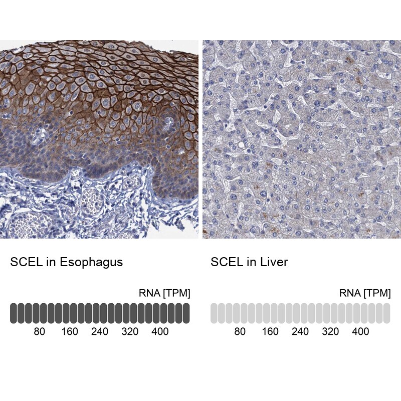 SCEL Antibody - BSA Free Immunohistochemistry-Paraffin: SCEL Antibody [NBP1-82138]