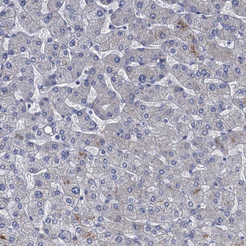 SCEL Antibody - BSA Free Immunohistochemistry-Paraffin: SCEL Antibody [NBP1-82138]