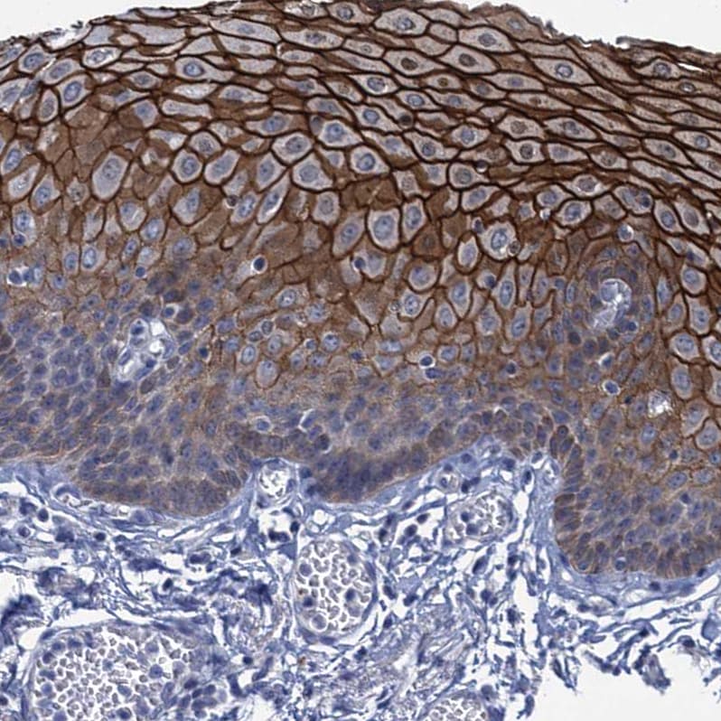 SCEL Antibody - BSA Free Immunohistochemistry-Paraffin: SCEL Antibody [NBP1-82138]