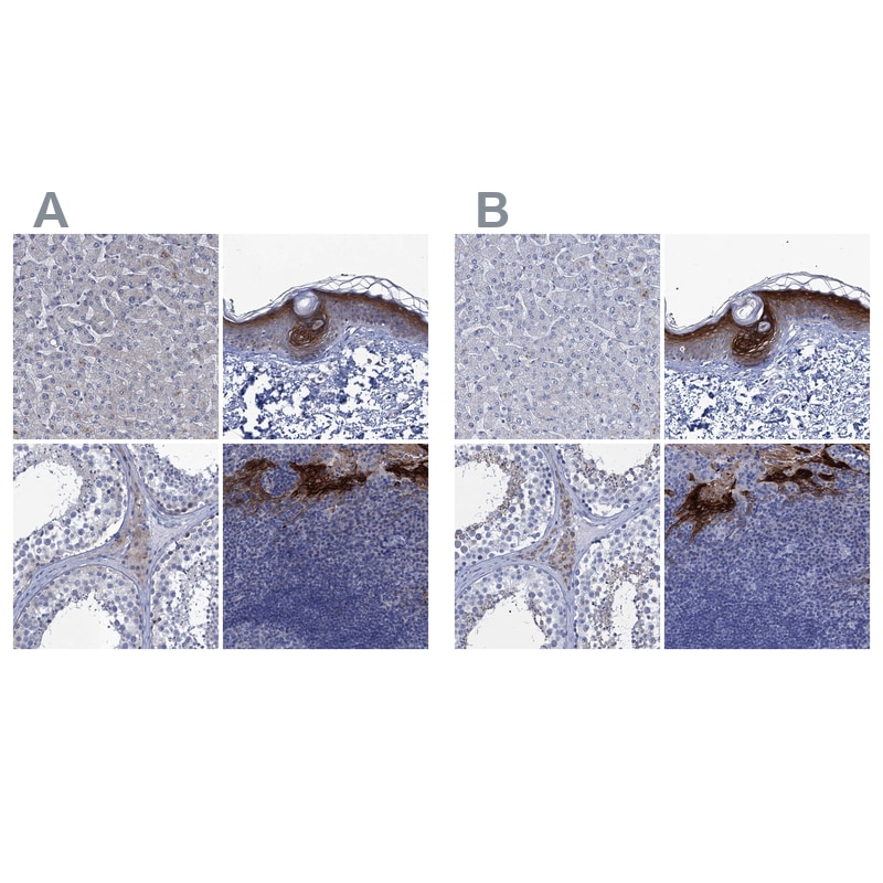 SCEL Antibody - BSA Free Immunohistochemistry-Paraffin: SCEL Antibody [NBP1-82138]