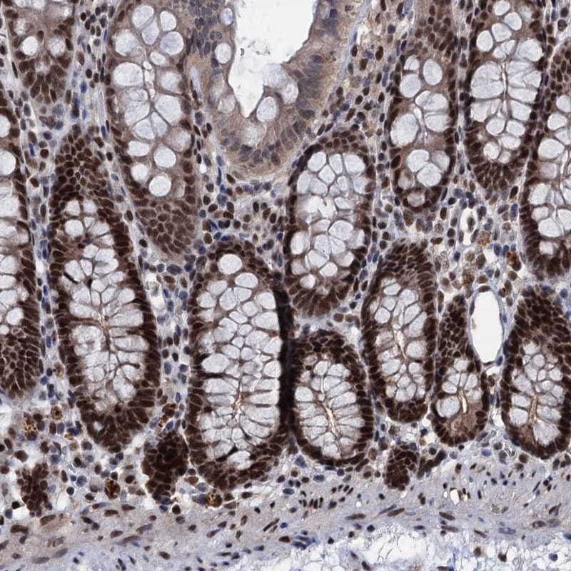 GALNT11 Antibody - BSA Free Immunohistochemistry: GALNT11 Antibody - BSA Free [NBP1-82140]