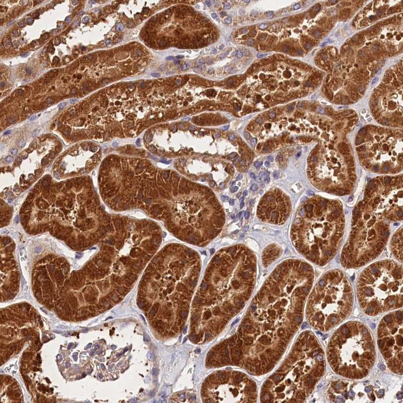 SPG11 Antibody - BSA Free Immunohistochemistry-Paraffin: SPG11 Antibody [NBP1-82143]