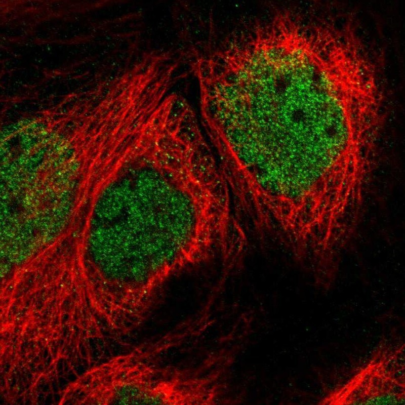 SPATA20 Antibody - BSA Free Immunocytochemistry/ Immunofluorescence: SPATA20 Antibody [NBP1-82147]
