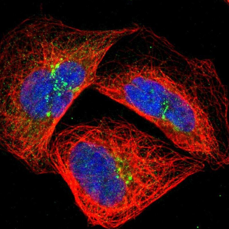 GRAMD3 Antibody - BSA Free Immunocytochemistry/ Immunofluorescence: GRAMD3 Antibody [NBP1-82150]