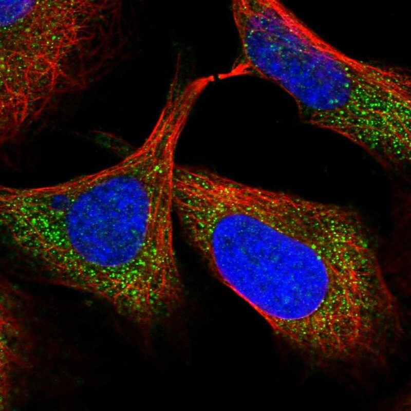 TTC38 Antibody - BSA Free Immunocytochemistry/ Immunofluorescence: TTC38 Antibody [NBP1-82163]