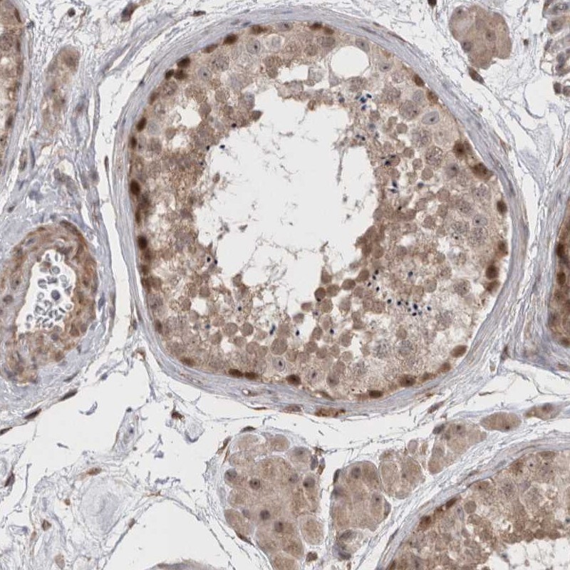 Exosome component 4 Antibody - BSA Free Immunohistochemistry-Paraffin: Exosome component 4 Antibody [NBP1-82170]