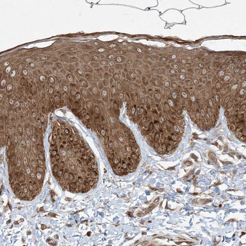 COMMD8 Antibody - BSA Free Immunohistochemistry-Paraffin: COMMD8 Antibody [NBP1-82178]