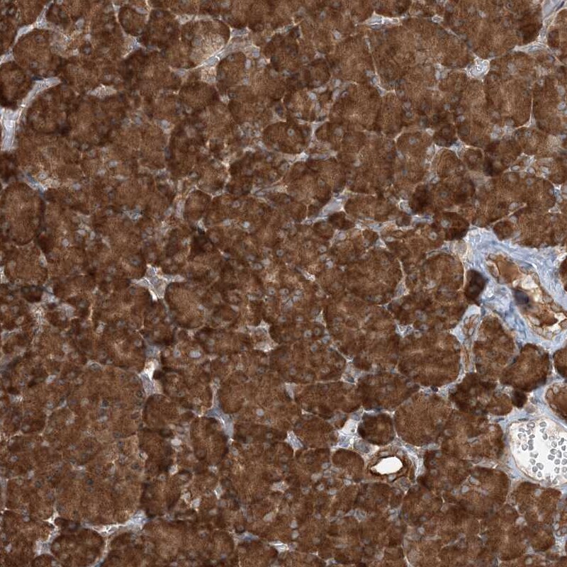 COMMD8 Antibody - BSA Free Immunohistochemistry-Paraffin: COMMD8 Antibody [NBP1-82178]