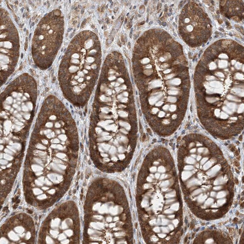 COMMD8 Antibody - BSA Free Immunohistochemistry-Paraffin: COMMD8 Antibody [NBP1-82178]