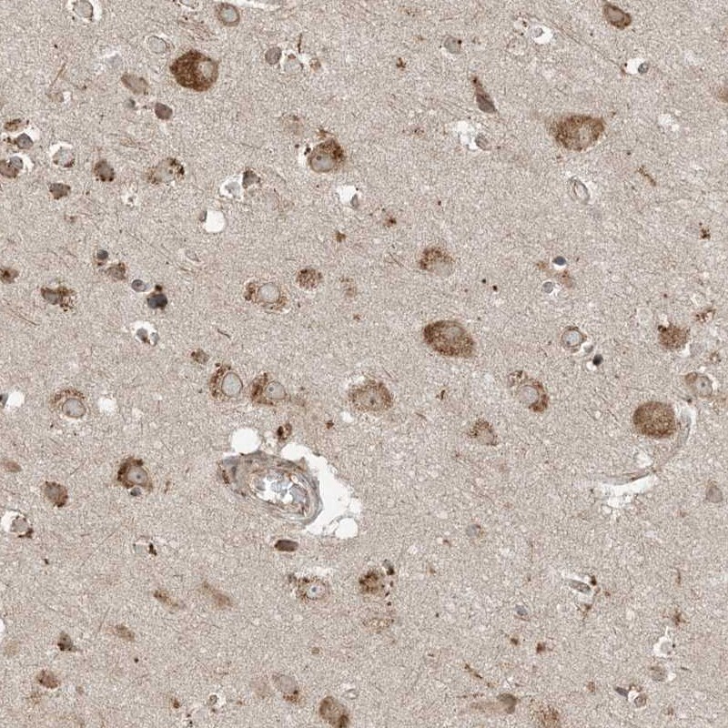 COMMD8 Antibody - BSA Free Immunohistochemistry-Paraffin: COMMD8 Antibody [NBP1-82178]