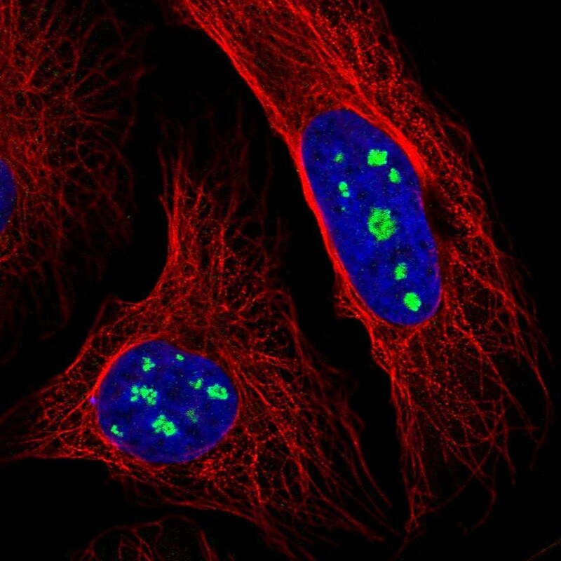 LRRC40 Antibody - BSA Free Immunocytochemistry/ Immunofluorescence: LRRC40 Antibody [NBP1-82185]