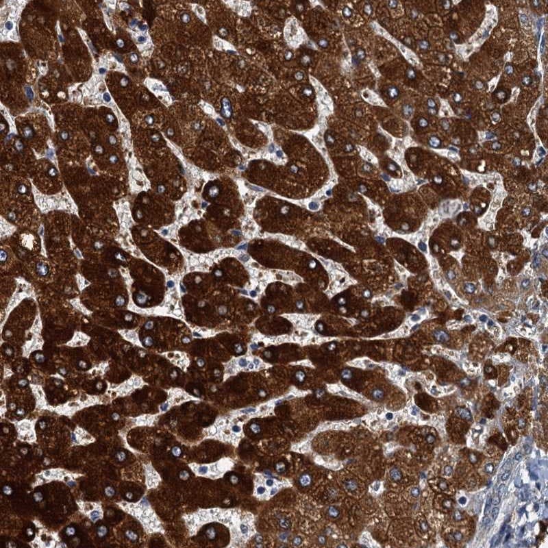 ZC3H7A Antibody - BSA Free Immunohistochemistry-Paraffin: ZC3H7A Antibody [NBP1-82187]