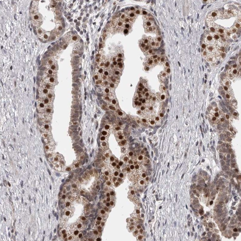 THUMPD1 Antibody - BSA Free Immunohistochemistry-Paraffin: THUMPD1 Antibody [NBP1-82194]