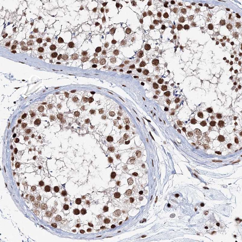 QRICH1 Antibody - BSA Free Immunohistochemistry-Paraffin: QRICH1 Antibody [NBP1-82196]