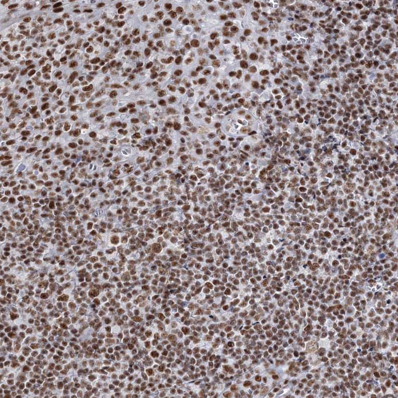 QRICH1 Antibody - BSA Free Immunohistochemistry-Paraffin: QRICH1 Antibody [NBP1-82196]