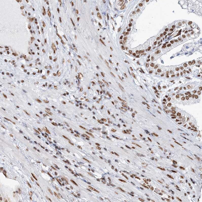 QRICH1 Antibody - BSA Free Immunohistochemistry-Paraffin: QRICH1 Antibody [NBP1-82196]