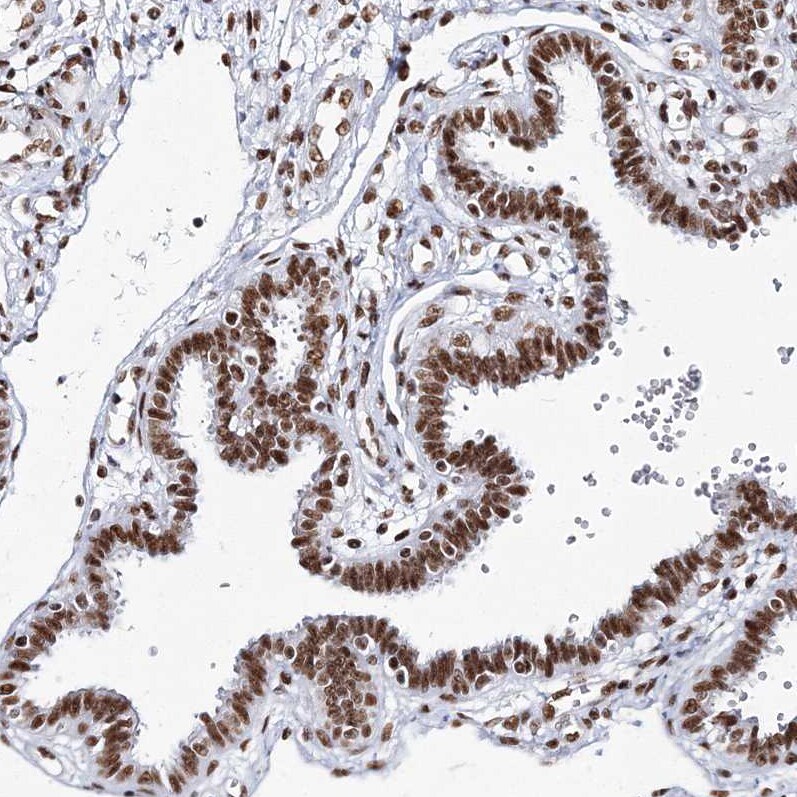 QRICH1 Antibody - BSA Free Immunohistochemistry-Paraffin: QRICH1 Antibody [NBP1-82196]