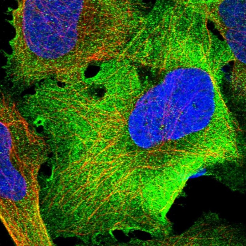 TRM1 Antibody - BSA Free Immunocytochemistry/ Immunofluorescence: TRM1 Antibody [NBP1-82197]